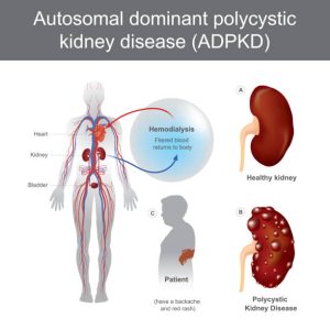 Kidney