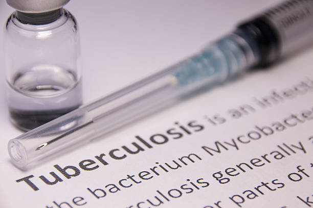 Tuberculosis