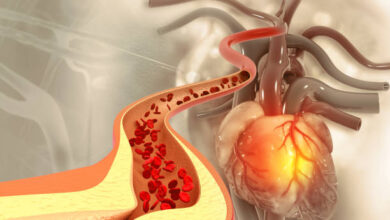 Cholesterol